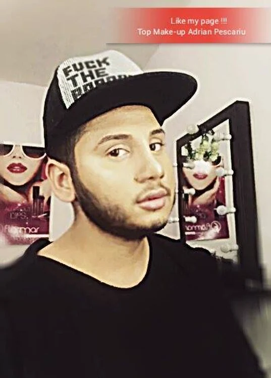 Adrian Pescariu şi-a operat pentru a treia oară nasul