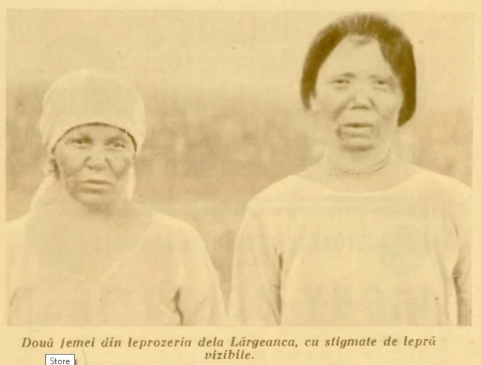 Femei bolnave de lepră ARhivă Realitatea ilustată, 1933, BCU Cluj