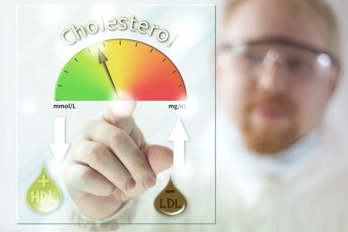 Nivelurile ridicate de LDL cresc riscul de atac de cord și AVC FOTO Shutterstock
