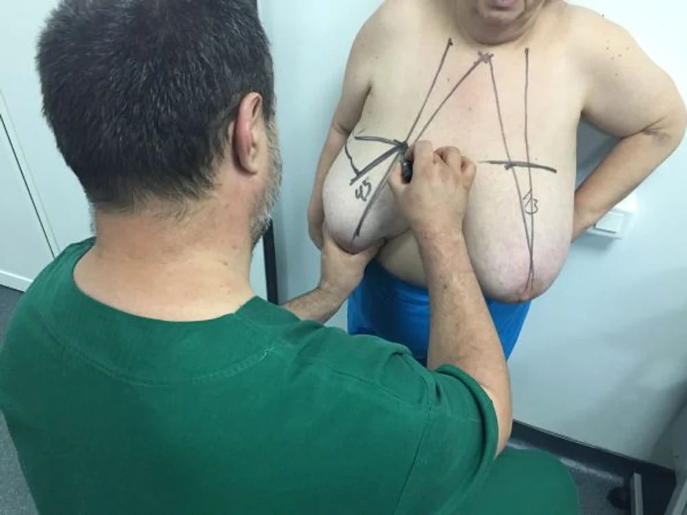 Procedura a durat 4 ore