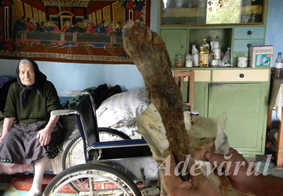 Femeia de 93 de ani şi-a ţinut 13 ani o parte din piciorul drept, mumificat, în podul casei