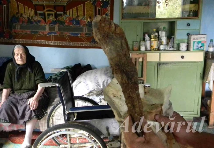 Femeia de 93 de ani şi-a ţinut 13 ani o parte din piciorul drept, mumificat, în podul casei
