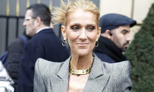 1 celine dion anorexica 8 jpg jpeg