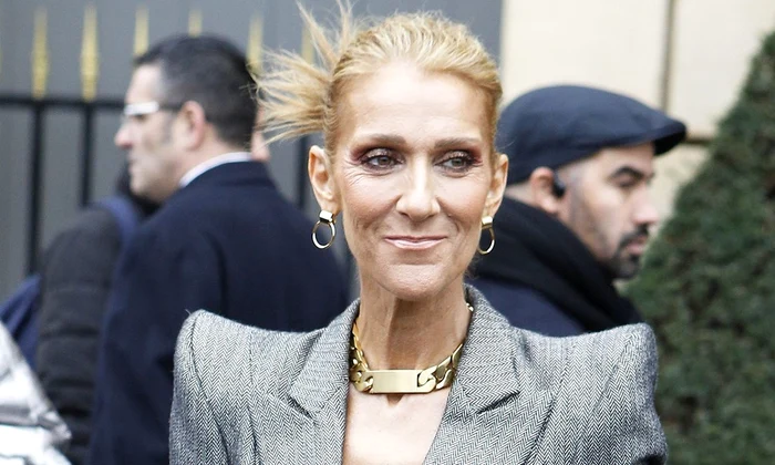 1 celine dion anorexica 8 jpg jpeg