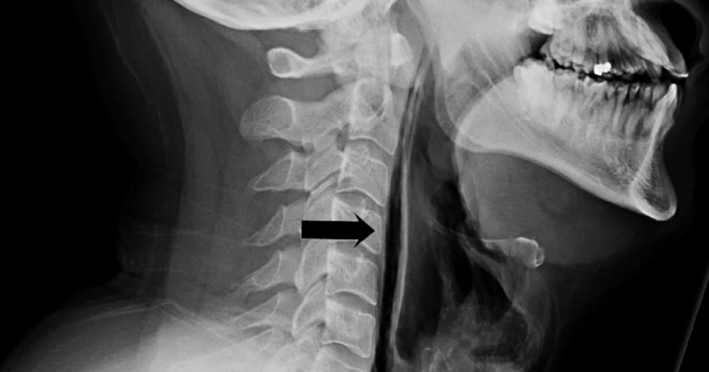 Radiografie 