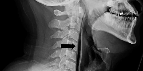 Radiografie 