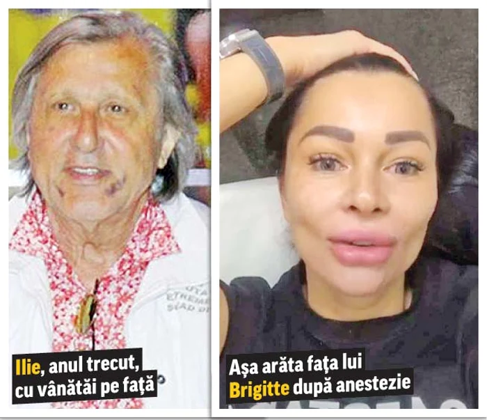 
    Brigitte Năstase,  cu ace înfipte în faţă.  Ea s-a filmat şi a  pus totul pe Instagram  