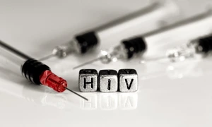 sange contaminat HIV foto shutterstock