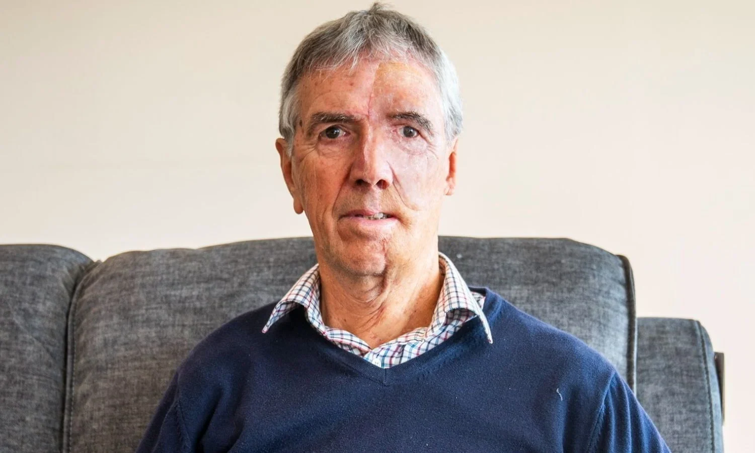 Un bărbat mutilat într-un accident și-a refăcut fața cu ajutorul tehnologiei 3D: „Nu este cel mai plăcut proces”