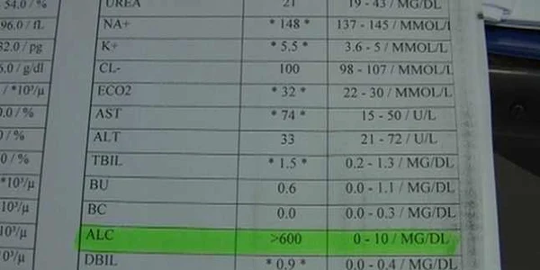 Fişa medicală cu alcoolemia bărbatului