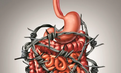 3 constipatie jpg jpeg