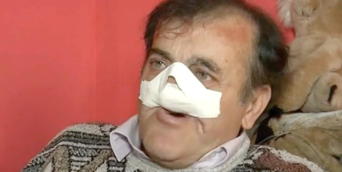 
    Gorjeanul Aristică Lălău nu mai are nas, dinţi şi nici cerul gurii   