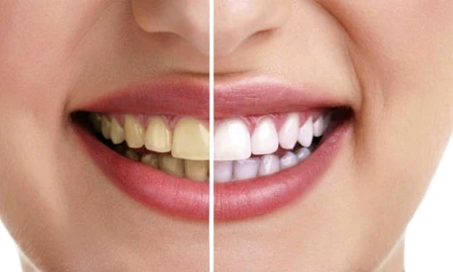 1 63071 original jpg jpeg