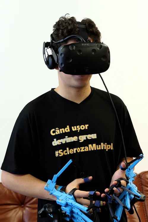 7 scleroza multipla 4 jpg jpeg