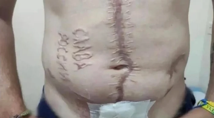 Fostul prizonier ucrainean a fost mutilat cu inscripţii ofensatoare. FOTO: social media