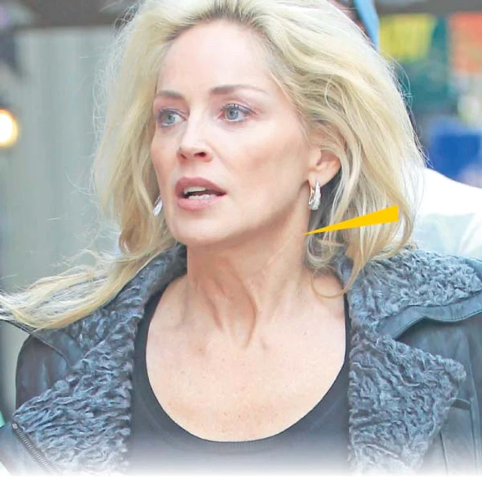 Sharon are o cicatrice pe gât de la o căzătură de pe cal din copilărie, când a fost pentru prima oară în pericol de moarte (Foto: Guliver / Splashnews)