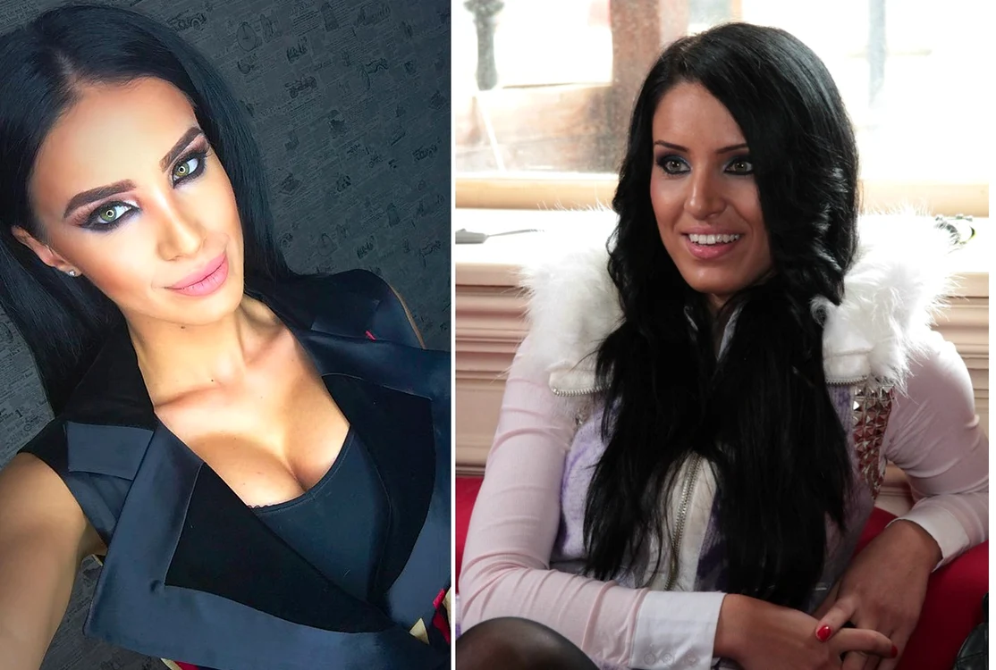 Adelina şi-a făcut rinoplastie şi şi-a mărit sânii