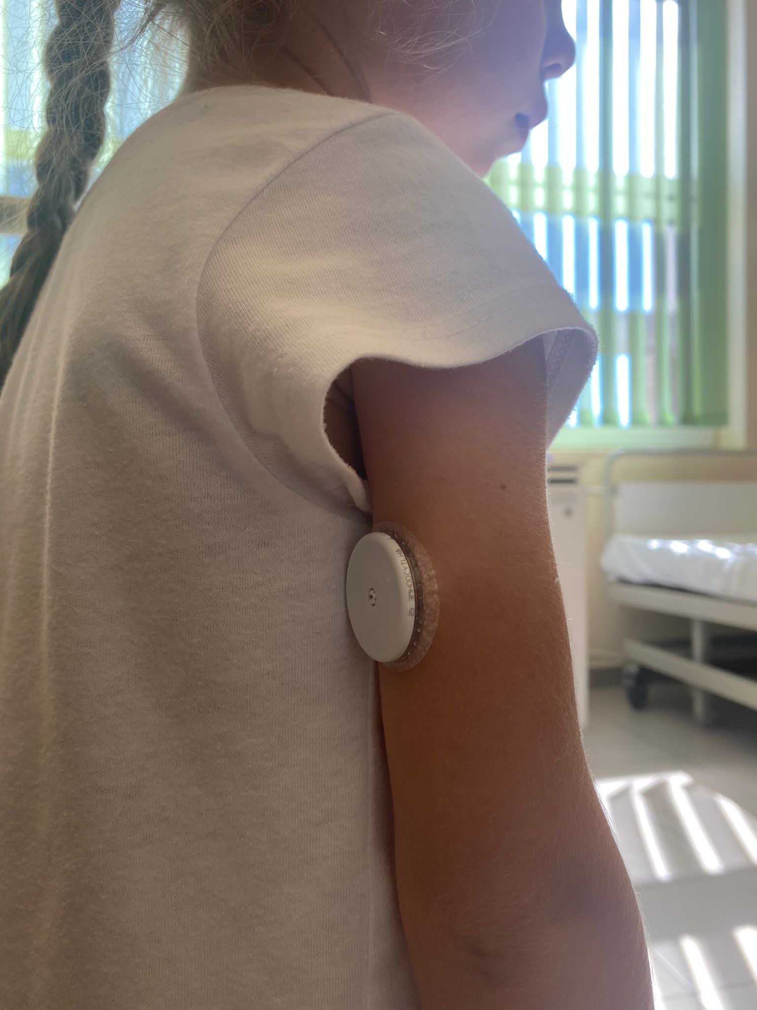 Copiii cu diabet nu primesc senzorii pentru măsurarea glicemiei din cauza lipsei de fonduri, conform CJAS Copiii cu diabet nu primesc senzorii pentru măsurarea glicemiei din cauza lipsei de fonduri, conform CJAS