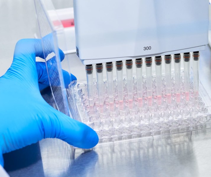 Un simplu test de de sânge ar putea anticipa riscul de demență cu până la 25 de ani înainte de simptome