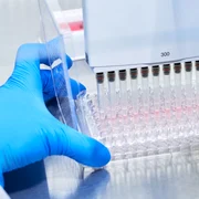 Alzheimer test sange roche jpeg