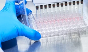 Alzheimer test sange roche jpeg