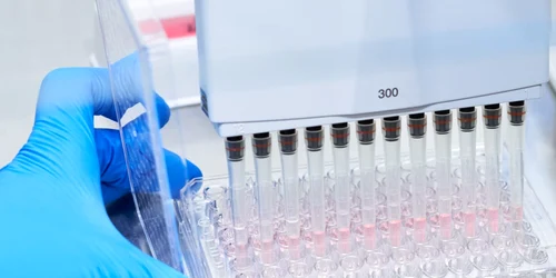 Alzheimer test sange roche jpeg