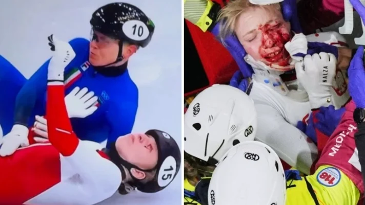 Momente de teroare la patinaj viteză: o sportivă a fost tăiată pe față de lama de la patina unei adversare