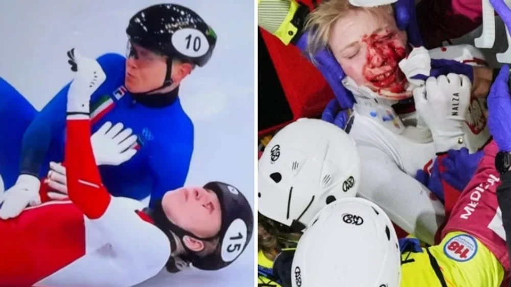 Momente de teroare la patinaj viteză: o sportivă a fost tăiată pe față de lama de la patina unei adversare