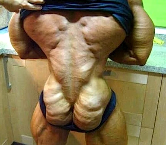 Steroizii şi efectele lor