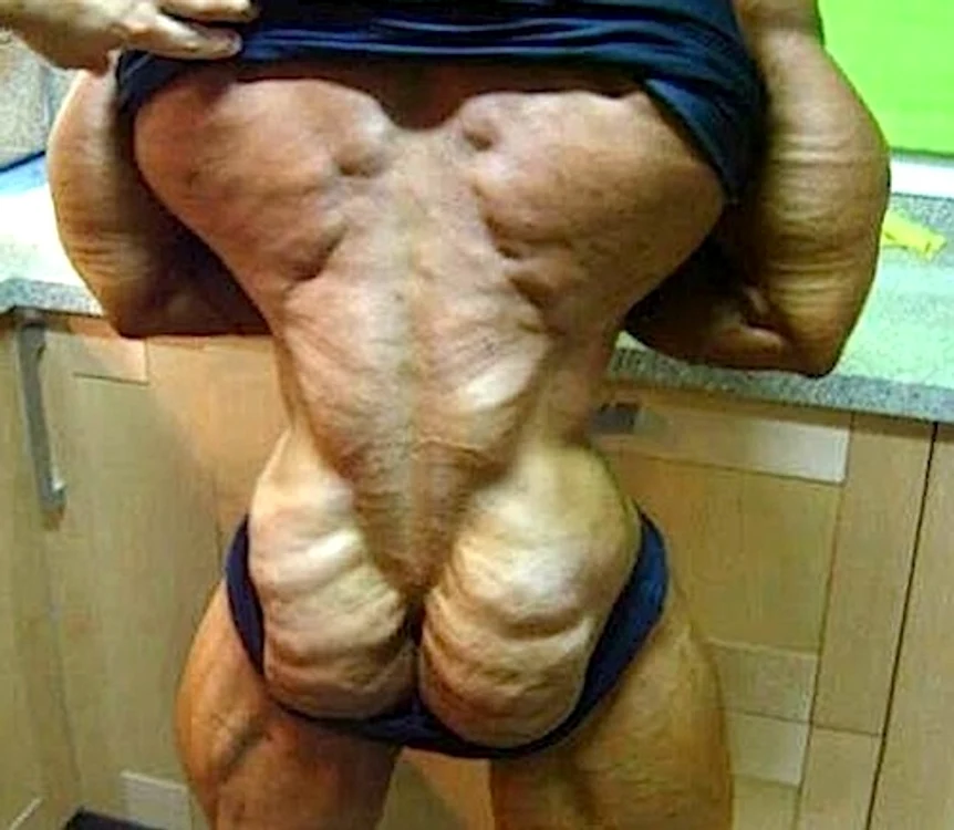 
    Steroizii şi efectele lor  