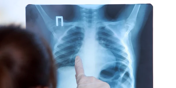 Radiografie