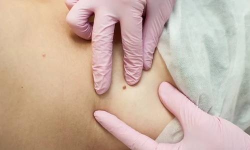 1 ce sunt papiloamele jpg jpeg