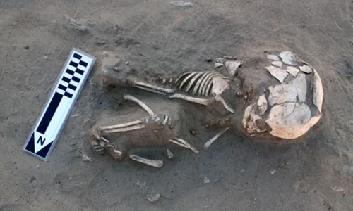 Primul caz de scorbut din lume, descoperit în Egipt jpeg