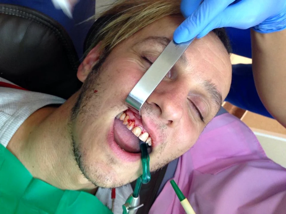 Imaginile pe care Trăistariu şi le-a făcut la dentist au ajuns apoi pe pagina lui de Facebook