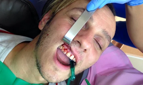 Imaginile pe care Trăistariu şi le a făcut la dentist au ajuns apoi pe pagina lui de Facebook jpeg