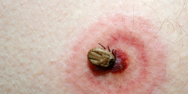 muscatura capuse