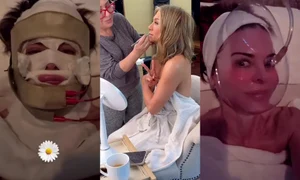 tratamente cosmetice  foto   Instagram jpg