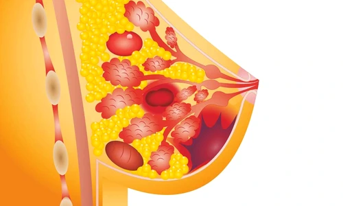 1 66073 original jpg jpeg