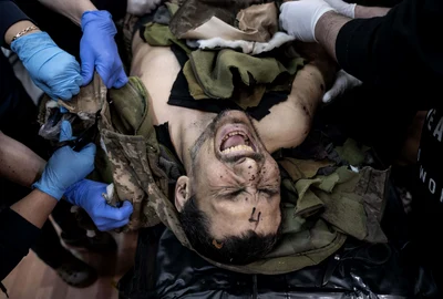 Soldat ucrainean rănit FOTO Profimedia 