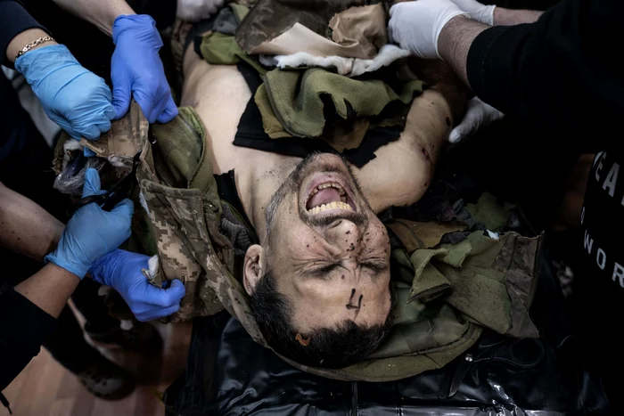 Medici tratează un soldat ucrainean rănit în Donețk FOTO Profimedia 