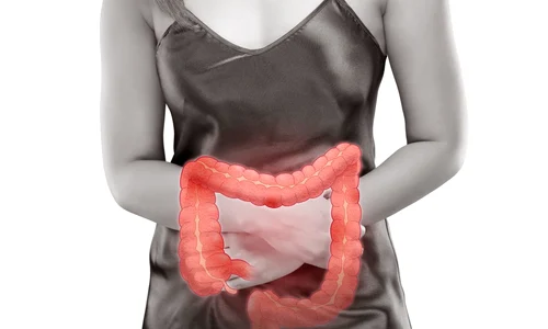 obstructie intestinala jpg