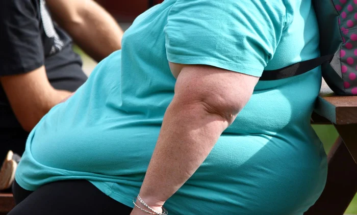 O femeie care suferea de obezitate şi-a sufocat accidental partenerul. FOTO: arhivă