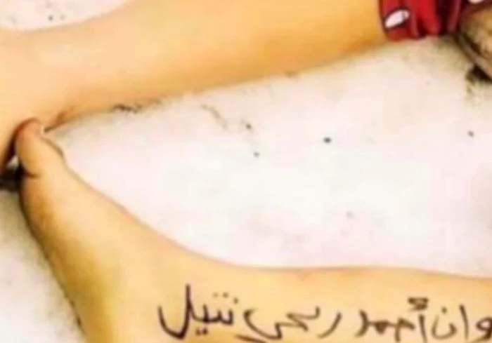 Copii în spitalul din Gaza, cu numele scris pe picioare FOTO Ștefan Abedelnaby