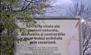 Panou cezariana 2 Sursa Reddit webp