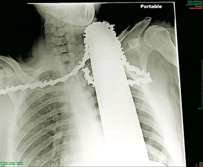 James Valentine (Fotografii: guliver/splashnews)