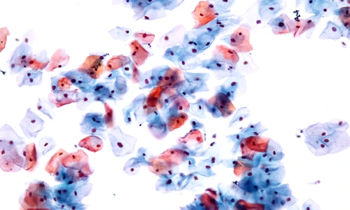 1 testpapanicolau jpg jpeg