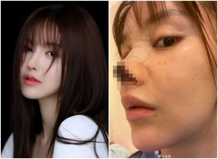 Gao Liu este o cântăreaţă şi actriţă care a jucat în mai multe filme şi programe TV