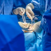 poza operatie interior jpg