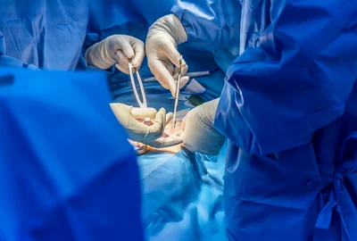 poza operatie interior jpg