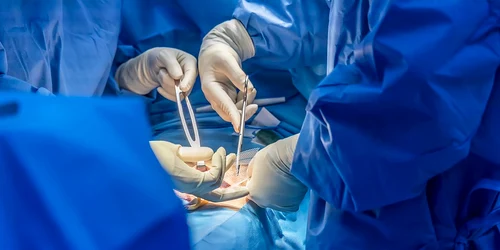 poza operatie interior jpg